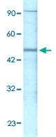 Anti-GABRP Rabbit Polyclonal Antibody