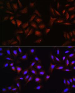 Immunofluorescence analysis of U-2 OS cells using Anti-Beta TRCP / HOS Antibody (A307151) at a dilution of 1:100. DAPI was used to stain the cell nuclei (blue).