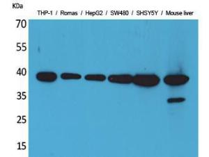 Western blot analysis of THP Romas, HepG SW480, SHSY5Y, mouse liver cells using Anti-IL10 Antibody