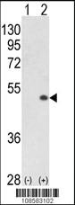 Anti-CDK16 Rabbit Polyclonal Antibody