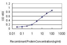 Anti-KIF2C Mouse Monoclonal Antibody [clone: 1G2]