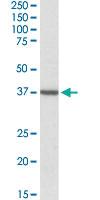 Anti-TOMM40 Goat Polyclonal Antibody