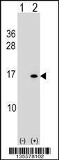 Anti-HIST2H2BE Rabbit Polyclonal Antibody (PE (Phycoerythrin))