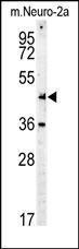 Anti-Myc Tag Mouse Monoclonal Antibody [clone: 9E10]