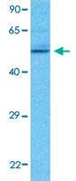 Anti-GABRP Rabbit Polyclonal Antibody