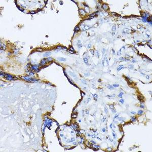 Immunohistochemistry analysis of paraffin-embedded human placenta using Anti-GRP78 BiP Antibody (A12567) at a dilution of 1:100 (40X lens). Perform microwave antigen retrieval with 10 mM PBS buffer pH 7.2 before commencing with IHC staining protocol