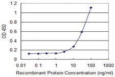 Anti-PML Mouse Monoclonal Antibody [clone: 2B10]