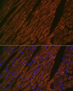 Immunofluorescence analysis of mouse heart using Anti-Desmin Antibody [ARC0235] (A305689) at a dilution of 1:100 (40X lens). DAPI was used to stain the cell nuclei (blue)