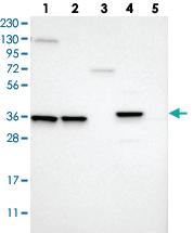 Anti-MARC2 Rabbit Polyclonal Antibody