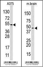 Anti-HIF1AN Rabbit Polyclonal Antibody (Biotin)