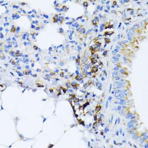 Immunohistochemistry analysis of paraffin-embedded mouse lung using Anti-GRP78 BiP Antibody (A12567) at a dilution of 1:100 (40X lens). Perform microwave antigen retrieval with 10 mM PBS buffer pH 7.2 before commencing with IHC staining protocol