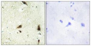 Anti-CHRC1 antibody