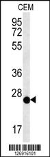 Anti-CRISPLD2 Rabbit Polyclonal Antibody