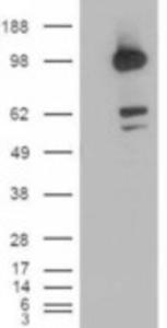 HEK293 overexpressing CDCP1 (RC220633) and probed with EB05267 (mock transfection in first lane), tested by Origene.