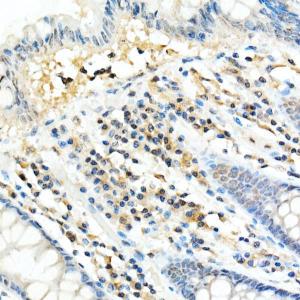 Immunohistochemistry analysis of paraffin-embedded human colon tissue using Anti-FADD Antibody [ARC51937] (A307153) at a dilution of 1:100 (40X lens). Perform high pressure antigen retrieval with 10 mM citrate buffer pH 6.0 before commencing with IHC staining protocol