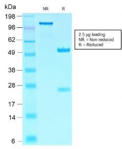 SDS-PAGE analysis of Anti-SOX10 Antibody [SOX10/2311R] under non-reduced and reduced conditions; showing intact IgG and intact heavy and light chains, respectively. SDS-PAGE analysis confirms the integrity and purity of the antibody