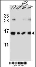 Anti-H2AFJ Rabbit Polyclonal Antibody