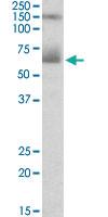 Anti-MSLN Goat Polyclonal Antibody