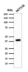 Antibody anti-cytokeratin 18 DA7 100 µg