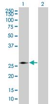 Anti-PMM2 Mouse Polyclonal Antibody