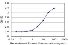 Anti-RUVBL1 Mouse Monoclonal Antibody [clone: 3G4-1F8]