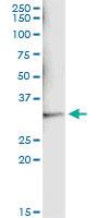 Anti-SULT1A1 Mouse Monoclonal Antibody [clone: 1F8]