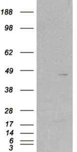 HEK293 overexpressing SKAP2 (RC206119)  and probed with EB05356 (mock transfection in first lane), tested by Origene.