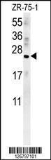 Anti-AVP Rabbit Polyclonal Antibody (HRP (Horseradish Peroxidase))