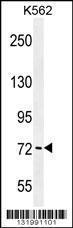 Anti-PAK6 Rabbit Polyclonal Antibody (FITC (Fluorescein Isothiocyanate))