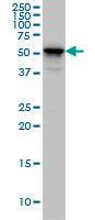 Anti-KRT4 Mouse Monoclonal Antibody [clone: 5H5]