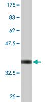 Anti-CECR1 Mouse Monoclonal Antibody [clone: 3D11]