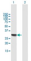 Anti-RDH16 Mouse Polyclonal Antibody