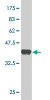 Anti-TTK Mouse Monoclonal Antibody [clone: 2F1]