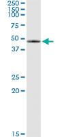 Anti-SERPINB2 Antibody Pair