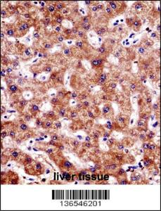 Anti-BCL7B Rabbit Polyclonal Antibody (AP (Alkaline Phosphatase))