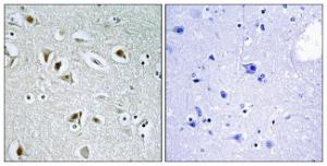 Antibody anti-CDKA2 100 µg