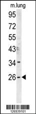 Anti-DNJC8 Rabbit Polyclonal Antibody