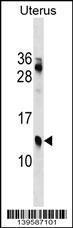 Anti-KLKP1 Rabbit Polyclonal Antibody