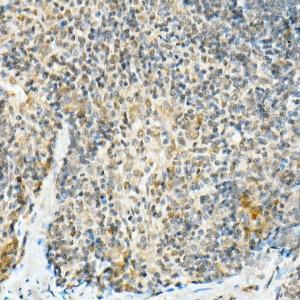 Immunohistochemistry analysis of paraffin-embedded mouse spleen using Anti-FADD Antibody [ARC51937] (A307153) at a dilution of 1:100 (40X lens). Perform high pressure antigen retrieval with 10 mM citrate buffer pH 6.0 before commencing with IHC staining protocol