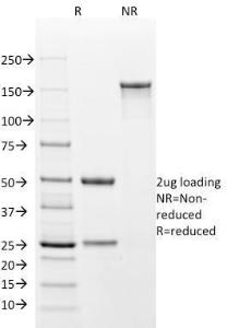 Antibody anti-cytokeratin 18 DA7 100 µg