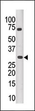 Anti-PIM3 Rabbit Polyclonal Antibody