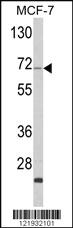 Anti-ZYG11A Rabbit Polyclonal Antibody