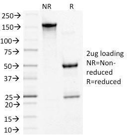 SDS-PAGE analysis of Anti-Desmoglein 3 Antibody [5G11] under non-reduced and reduced conditions; showing intact IgG and intact heavy and light chains, respectively. SDS-PAGE analysis confirms the integrity and purity of the antibody