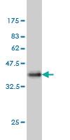 Anti-SRF Mouse Monoclonal Antibody [clone: 2G2]