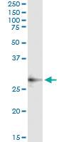 Anti-CECR1 Antibody Pair