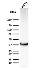 Anti-GLUT1 antibody