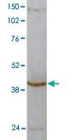 Anti-SERPINB2 Rabbit Polyclonal Antibody