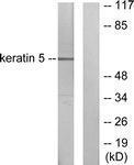 Anti-KRT5 Rabbit Polyclonal Antibody