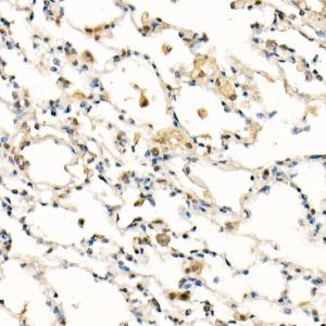 Immunohistochemistry analysis of paraffin-embedded rat lung using Anti-FADD Antibody [ARC51937] (A307153) at a dilution of 1:100 (40X lens). Perform high pressure antigen retrieval with 10 mM citrate buffer pH 6.0 before commencing with IHC staining protocol