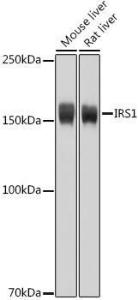 Western blot analysis of extracts of various cell lines, using Anti-IRS1 Antibody (A12569) at 1:1,000 dilution. The secondary antibody was Goat Anti-Rabbit IgG H&L Antibody (HRP) at 1:10,000 dilution.